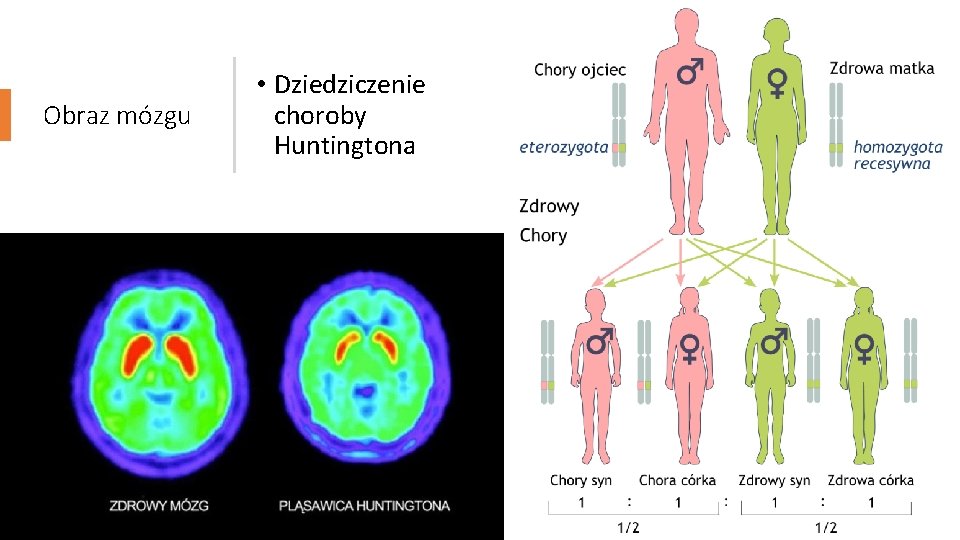 Obraz mózgu • Dziedziczenie choroby Huntingtona 