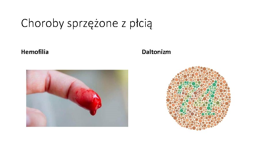 Choroby sprzężone z płcią Hemofilia Daltonizm 