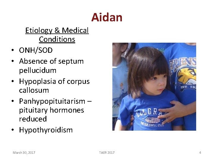 Aidan • • • Etiology & Medical Conditions ONH/SOD Absence of septum pellucidum Hypoplasia