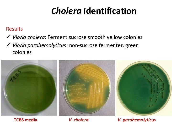 Cholera identification Results ü Vibrio cholera: Ferment sucrose smooth yellow colonies ü Vibrio parahemolyticus: