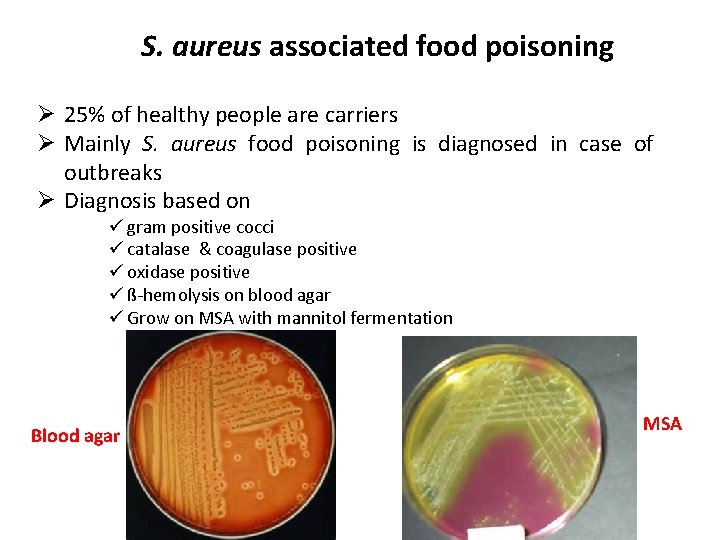 S. aureus associated food poisoning Ø 25% of healthy people are carriers Ø Mainly