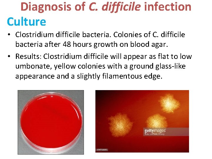 Diagnosis of C. difficile infection Culture • Clostridium difficile bacteria. Colonies of C. difficile