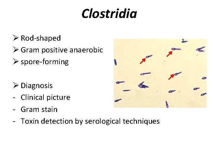 Clostridia Ø Rod-shaped Ø Gram positive anaerobic Ø spore-forming Ø Diagnosis - Clinical picture