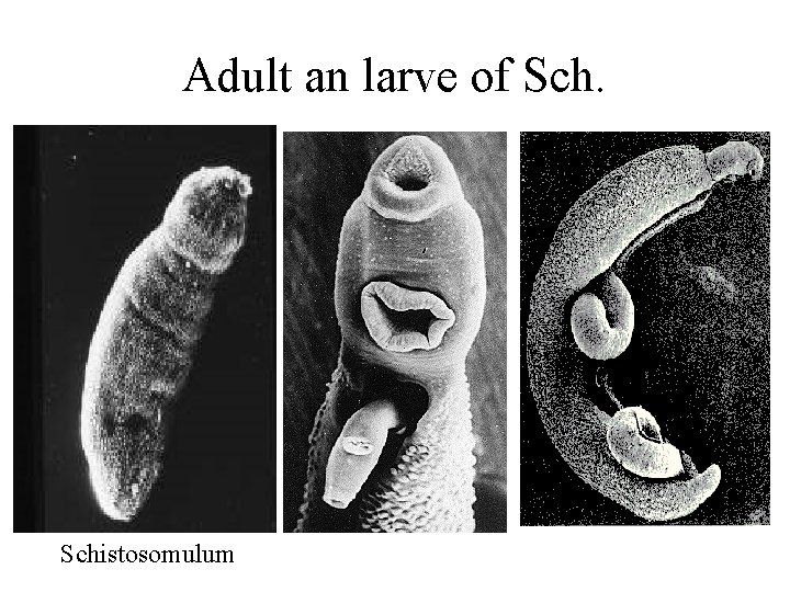 Adult an larve of Schistosomulum 