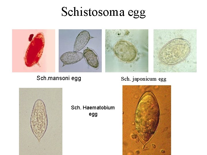 Schistosoma egg • JK Sch. mansoni egg Sch. Haematobium egg Sch. japonicum egg 