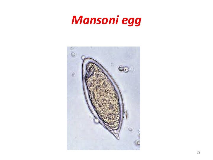 Mansoni egg 23 