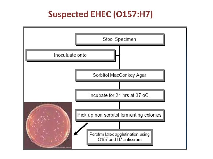 Suspected EHEC (O 157: H 7) 