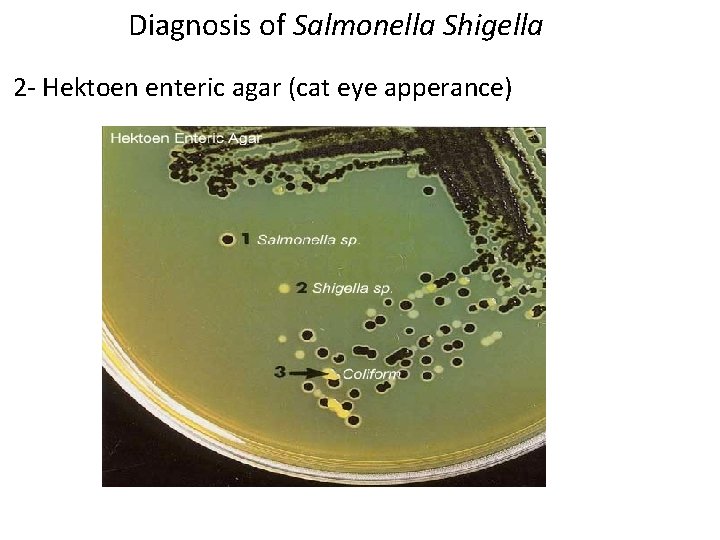 Diagnosis of Salmonella Shigella 2 - Hektoen enteric agar (cat eye apperance) 