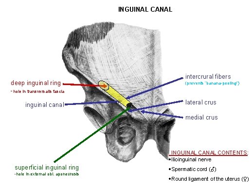 INGUINAL CANAL deep inguinal ring -hole in transversalis fascia inguinal canal intercrural fibers (prevents