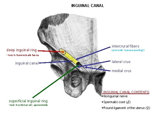 INGUINAL CANAL deep inguinal ring -hole in transversalis fascia inguinal canal intercrural fibers (prevents INGUINAL CANAL deep inguinal ring -hole in transversalis fascia inguinal canal intercrural fibers (prevents
