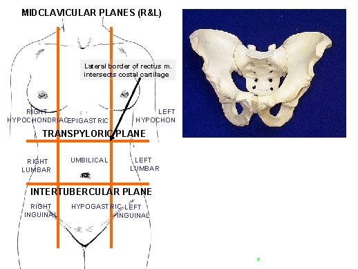 MIDCLAVICULAR PLANES (R&L) Lateral border of rectus m. intersects costal cartilage RIGHT EPIGASTRIC HYPOCHONDRIACEPIGASTRIC