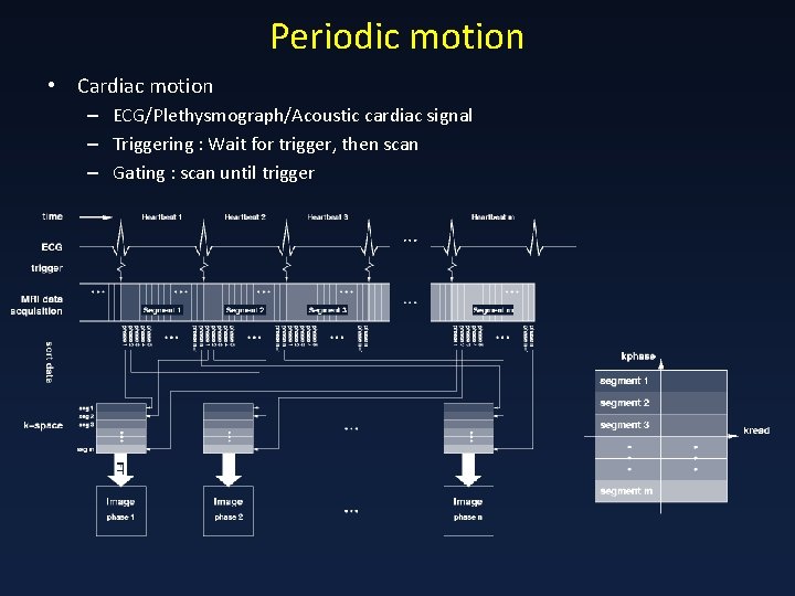 Periodic motion • Cardiac motion – ECG/Plethysmograph/Acoustic cardiac signal – Triggering : Wait for