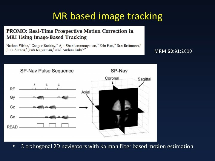 MR based image tracking MRM 63: 91: 2010 • 3 orthogonal 2 D navigators