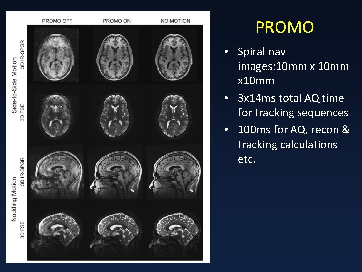 PROMO • Spiral nav images: 10 mm x 10 mm • 3 x 14