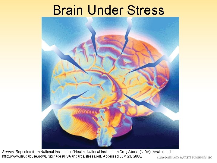 Brain Under Stress Source: Reprinted from National Institutes of Health, National Institute on Drug