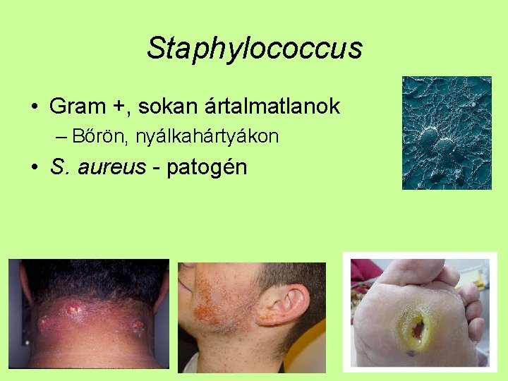 Staphylococcus • Gram +, sokan ártalmatlanok – Bőrön, nyálkahártyákon • S. aureus - patogén
