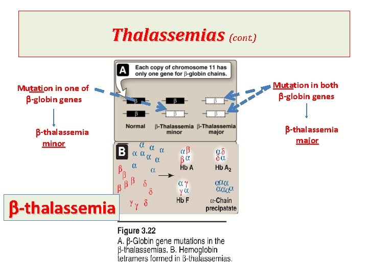 Thalassemias (cont. ) Mutation in one of b-globin genes Mutation in both b-globin genes