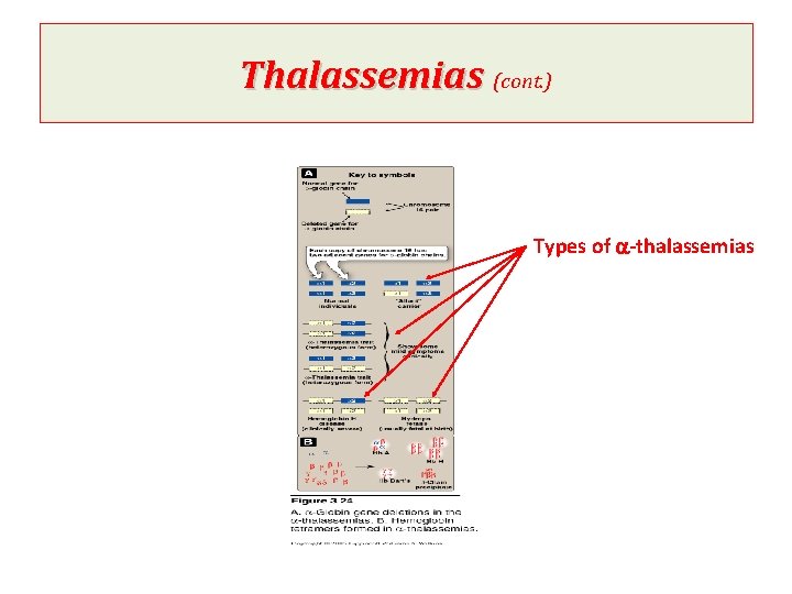 Thalassemias (cont. ) Types of a-thalassemias 