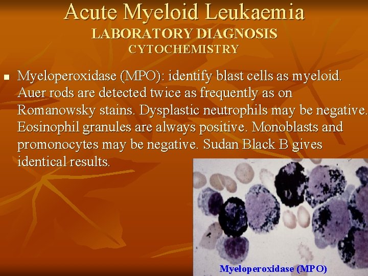 Acute Myeloid Leukaemia LABORATORY DIAGNOSIS CYTOCHEMISTRY n Myeloperoxidase (MPO): identify blast cells as myeloid.