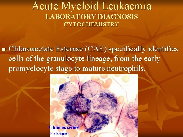 Acute Myeloid Leukaemia LABORATORY DIAGNOSIS CYTOCHEMISTRY n Chloroacetate Esterase (CAE) specifically identifies cells of