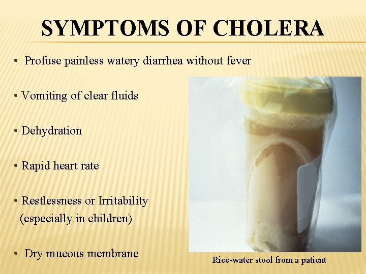 SYMPTOMS OF CHOLERA • Profuse painless watery diarrhea without fever • Vomiting of clear