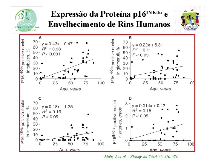 Expressão da Proteína p 16 INK 4 a e Envelhecimento de Rins Humanos Melk,