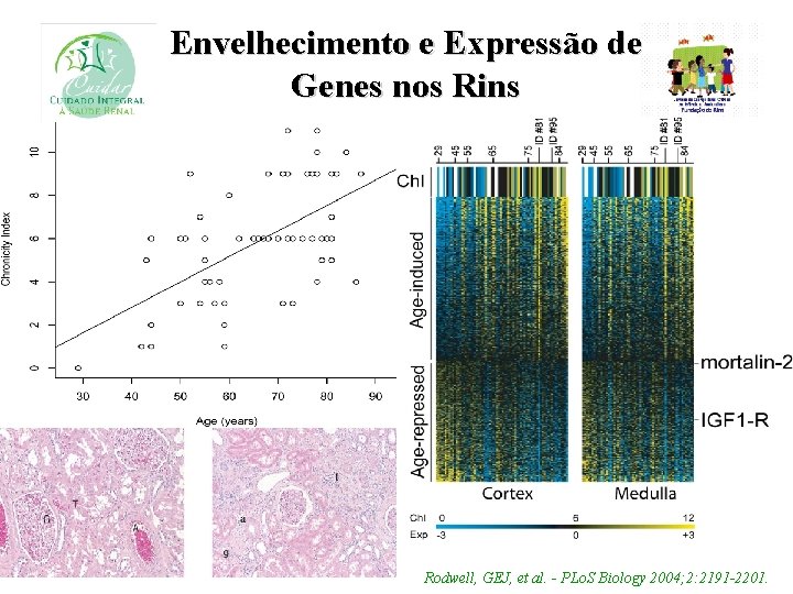Envelhecimento e Expressão de Genes nos Rins Rodwell, GEJ, et al. - PLo. S