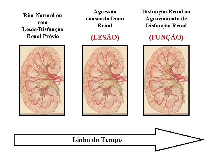 Rim Normal ou com Lesão/Disfunção Renal Prévia Agressão causando Dano Renal Disfunção Renal ou