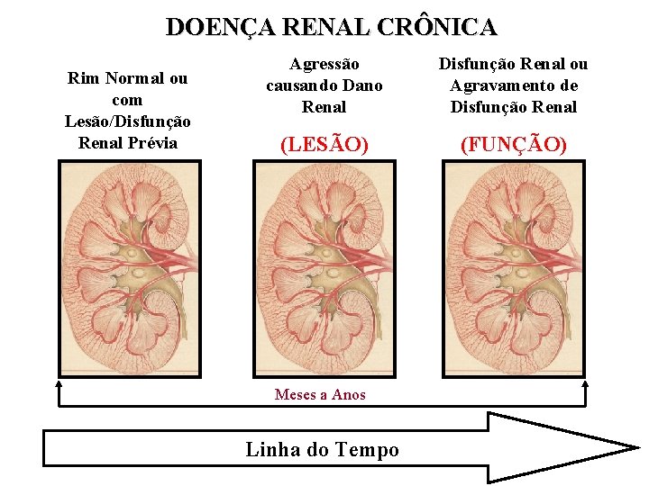 DOENÇA RENAL CRÔNICA Rim Normal ou com Lesão/Disfunção Renal Prévia Agressão causando Dano Renal