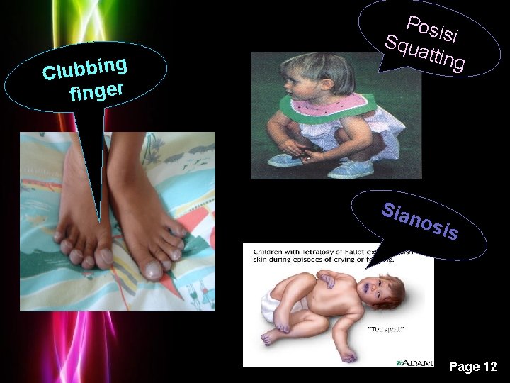 g n i b b u l C finger Posi Squ si attin g g n i b b u l C finger Posi Squ si attin g