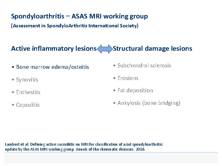 Spondyloarthritis – ASAS MRI working group (Assessment in Spondylo. Arthritis International Society) Active inflammatory