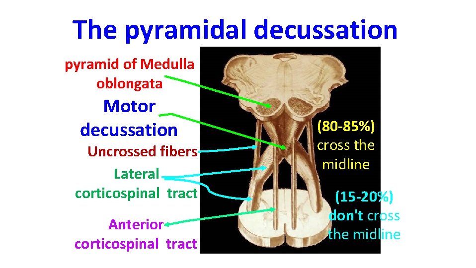 The pyramidal decussation pyramid of Medulla oblongata Motor decussation Uncrossed fibers Lateral corticospinal tract