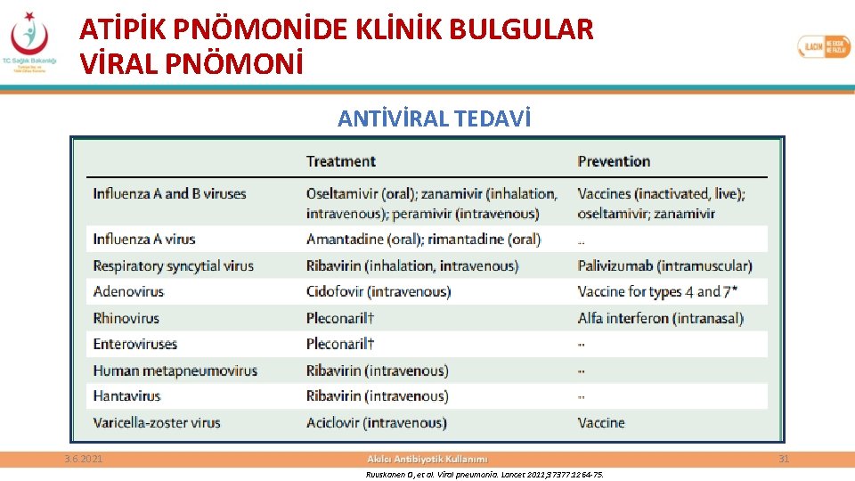 ATİPİK PNÖMONİDE KLİNİK BULGULAR VİRAL PNÖMONİ ANTİVİRAL TEDAVİ 3. 6. 2021 31 Ruuskanen O,