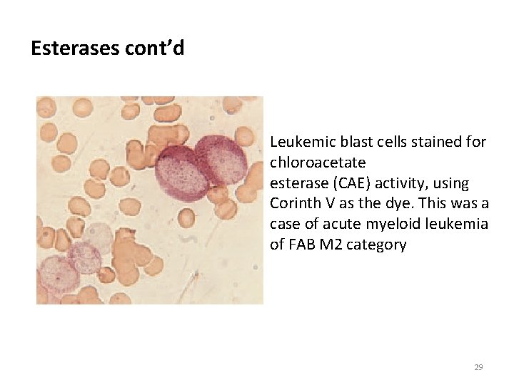 Esterases cont’d Leukemic blast cells stained for chloroacetate esterase (CAE) activity, using Corinth V