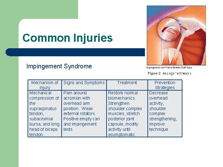 Common Injuries Impingement Syndrome Mechanism of Injury Mechanical compression of the supraspinatus tendon, subacromial