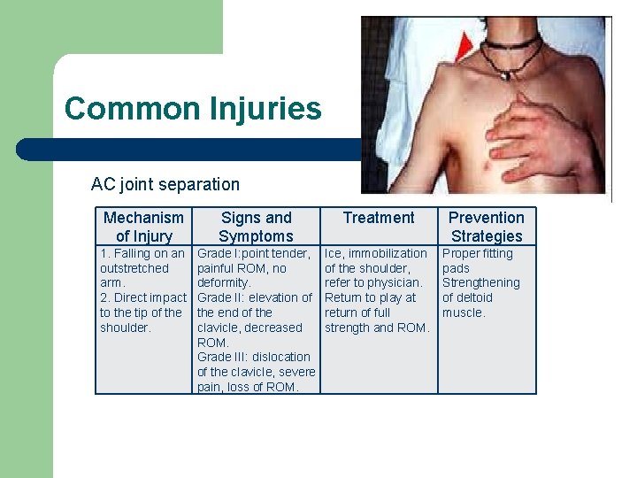 Common Injuries AC joint separation Mechanism of Injury Signs and Symptoms Treatment 1. Falling