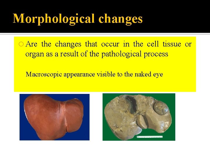 Morphological changes Are the changes that occur in the cell tissue or organ as