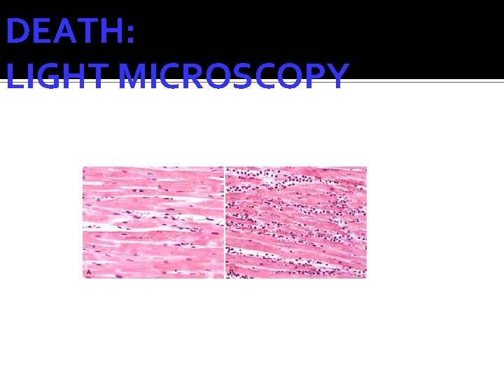 DEATH: LIGHT MICROSCOPY 
