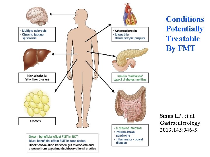 Conditions Potentially Treatable By FMT Smits LP, et al. Gastroenterology 2013; 145: 946 -53