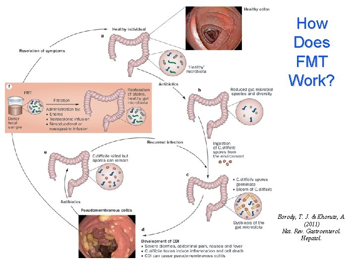 How Does FMT Work? Borody, T. J. & Khoruts, A. (2011) Nat. Rev. Gastroenterol.