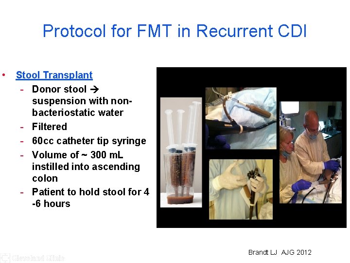 Protocol for FMT in Recurrent CDI • Stool Transplant - Donor stool suspension with