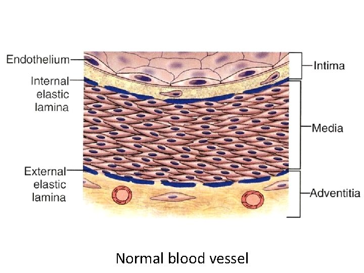 Normal blood vessel 