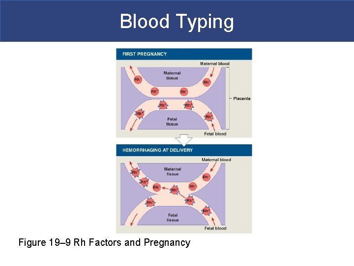 Blood Typing Figure 19– 9 Rh Factors and Pregnancy 