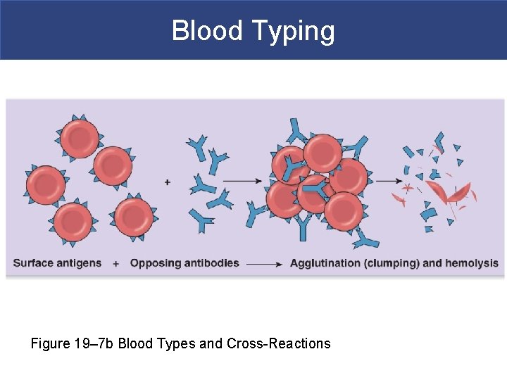 Blood Typing Figure 19– 7 b Blood Types and Cross-Reactions 