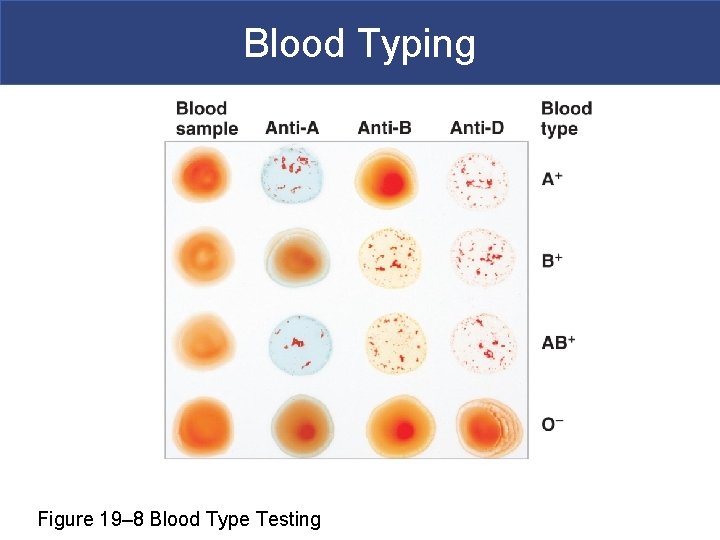 Blood Typing Figure 19– 8 Blood Type Testing 