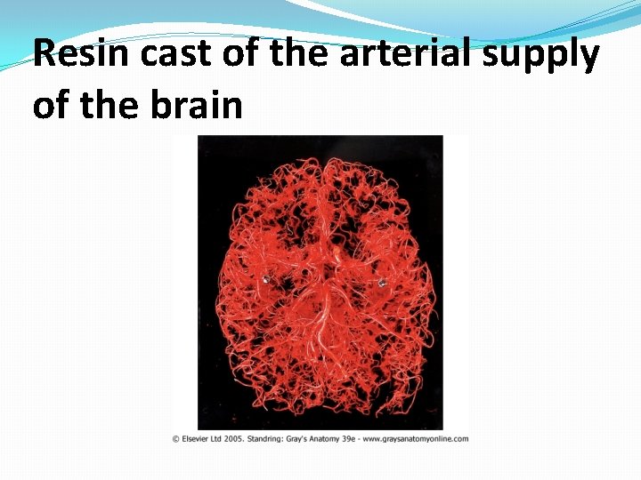 Resin cast of the arterial supply of the brain 