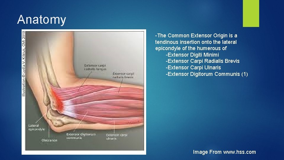 Anatomy -The Common Extensor Origin is a tendinous insertion onto the lateral epicondyle of