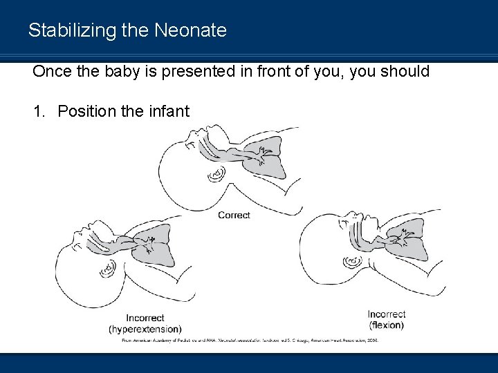Stabilizing the Neonate Once the baby is presented in front of you, you should