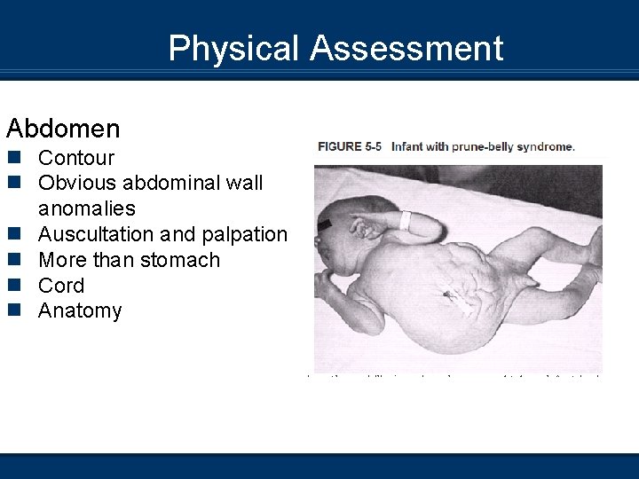Physical Assessment Abdomen n Contour n Obvious abdominal wall anomalies n Auscultation and palpation