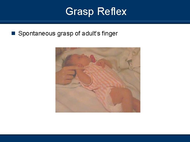 Grasp Reflex n Spontaneous grasp of adult’s finger 